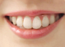 �C���[�W